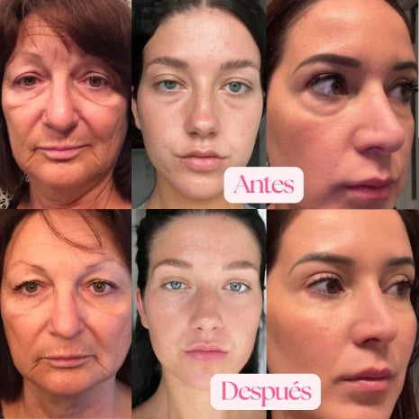 Mascarilla de Colágeno + Hidrogel para Ojos (10 sobres)